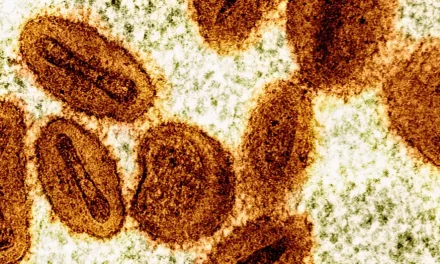 Detectan en Alemania un caso de la nueva variante de mpox