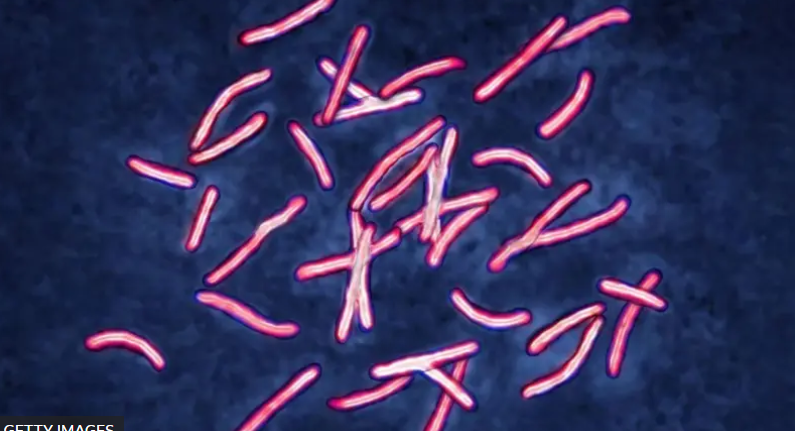 El problema sobre superbacterias que tomó años para ser resuelto por los científicos y que la IA solucionó en dos días
