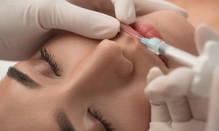 Rejuvenecimiento sin bisturí: todo sobre el bótox y los hilos tensores