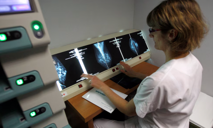 Un innovador tratamiento contra el cáncer de mama hereditario logró una supervivencia del 100%