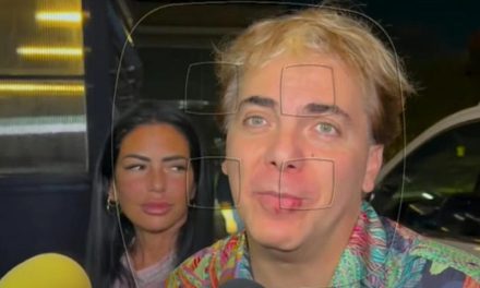 Cristian Castro llama la atención por el aspecto de sus labios
