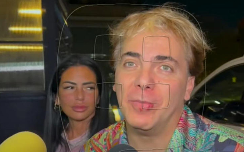 Cristian Castro llama la atención por el aspecto de sus labios