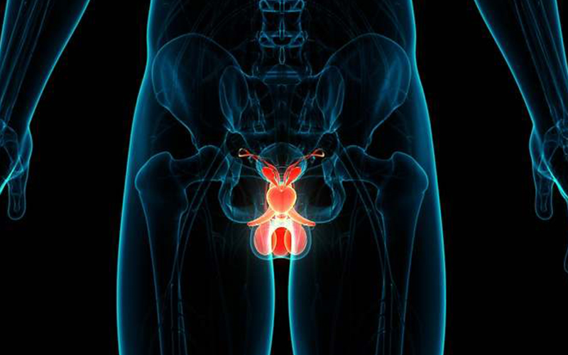 La prueba que detecta el cáncer de próstata a tiempo: estos son los síntomas, diagnóstico y mortalidad