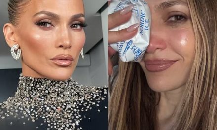 Jennifer Lopez sufrió un golpe en su rostro durante los ensayos de los AMAs