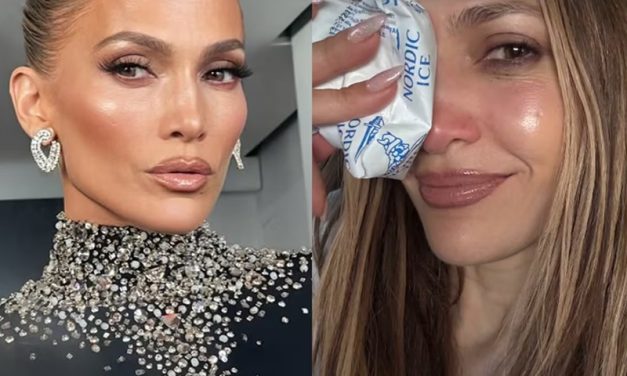 Jennifer Lopez sufrió un golpe en su rostro durante los ensayos de los AMAs