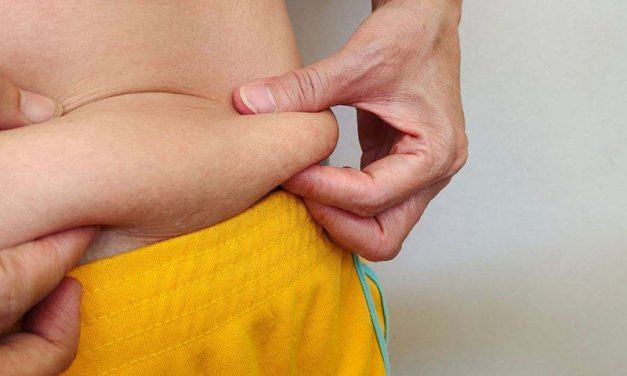 Cómo evitar que la piel se quede flácida después de perder peso: estos son los alimentos que debes comer todos los días