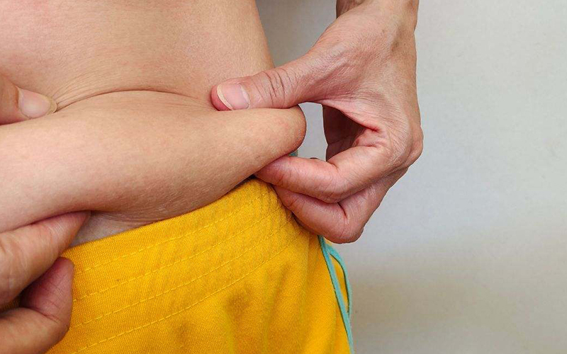 Cómo evitar que la piel se quede flácida después de perder peso: estos son los alimentos que debes comer todos los días