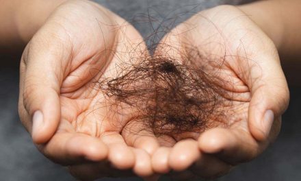 La terapia que hace crecer el cabello rápido y evitar la alopecia