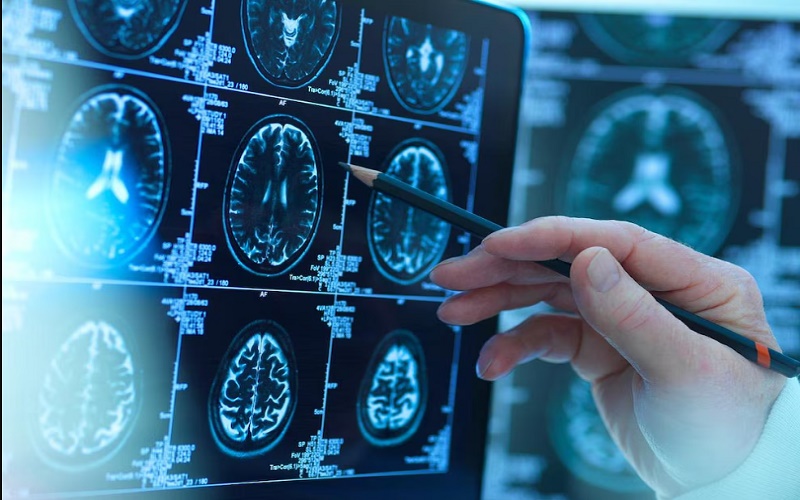 Cómo crece el cerebro de un bebé en los primeros años de vida