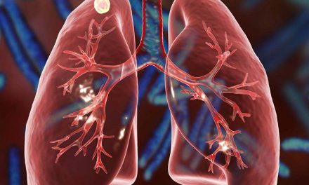 Cuál es la mejor fruta para limpiar los pulmones de manera natural: tienes 2 opciones